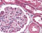 Endostatin Antibody